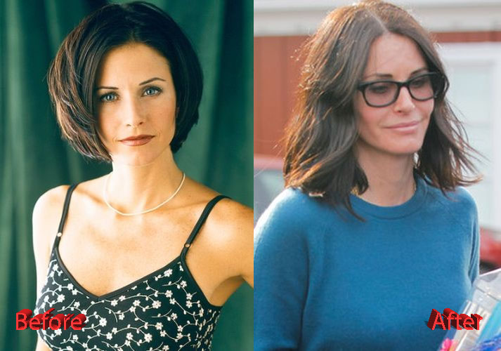 Courteney Cox Plastic Surgery did she went overboard?