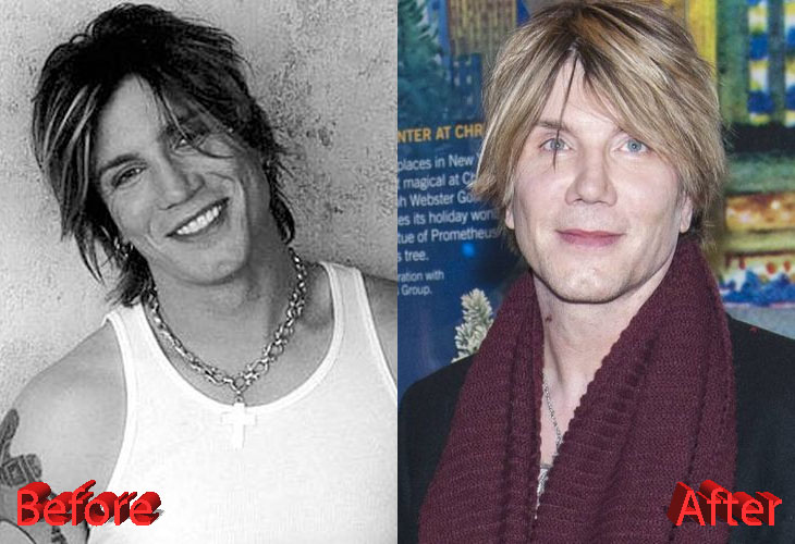 John Rzeznik Plastic Surgery Was It A Win Or Fail 