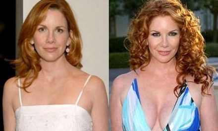 Melissa Gilbert’s Stunning Transformation: Plastic Surgery Secrets Unveiled!