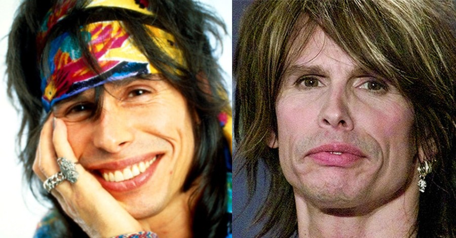 Steven Tyler plastic surgery before and after