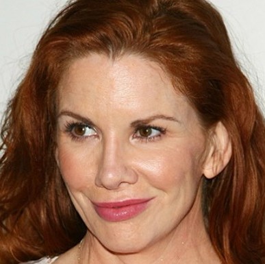 melissa gilbert plastic surgery