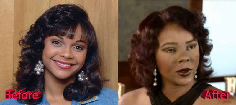 Lark Voorhies Plastic Surgery Gone Wrong