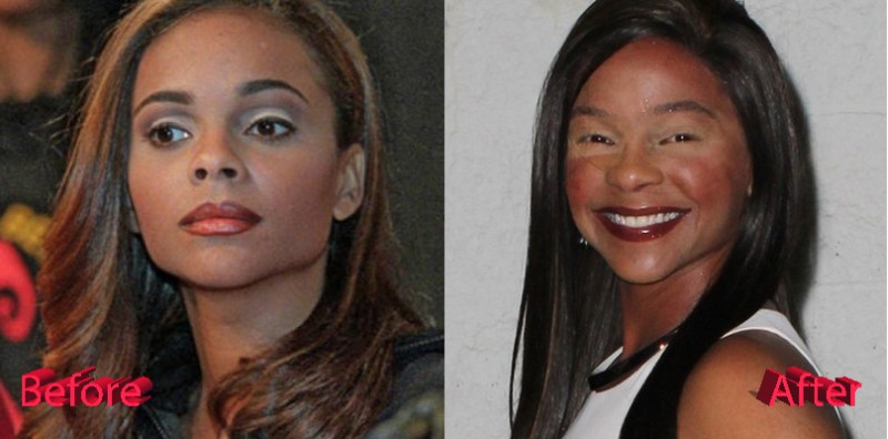 Lark Voorhies Plastic Surgery before and after photos