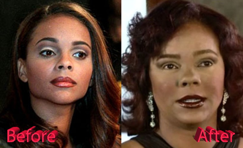 Lark Voorhies plastic surgery before and after