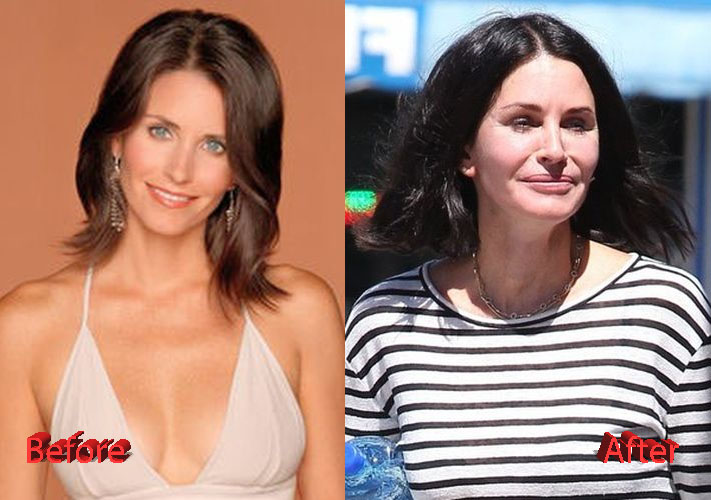 Courteney Cox Plastic Surgery