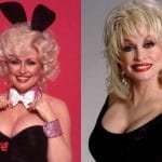 Dolly Parton Before and After Facelift