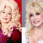 Dolly Parton Before and After Plastic Surgery 150x150