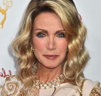 Donna Mills Plastic Surgery: She Admitted a Facelift — But Says That Was It 👀