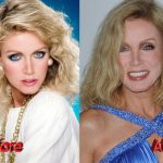 Donna Mills Before and After Plastic Surgery