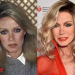 Donna Mills Plastic Surgery Transformation 150x150