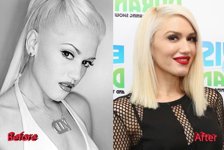 Gwen Stefani Before and After Transformation