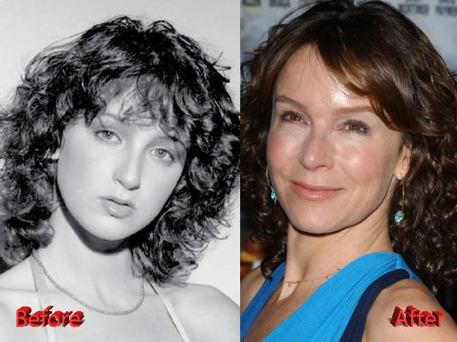 Jennifer Grey Nose Job Disaster