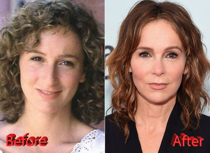 Jennifer Grey Nose Job Transformation2