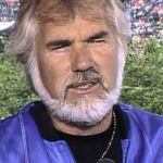 Kenny Rogers Before Facelift Transformation 150x150