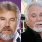 Kenny Rogers Facelift Surgery 150x150