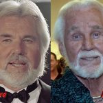 Kenny Rogers Plastic Surgery Fail 150x150