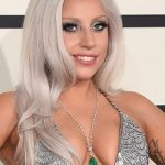 Lady Gaga After Plastic Surgery 150x150