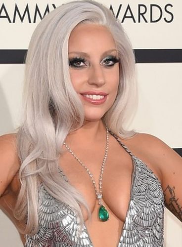 Lady Gaga After Plastic Surgery
