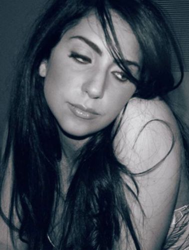Lady Gaga Before Pastic Surgery