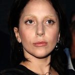 Lady Gaga Before Surgery 150x150
