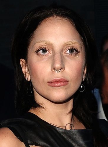 Lady Gaga Before Surgery
