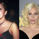 Lady Gaga Before and After Plastic Surgery 150x150