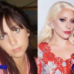 Lady Gaga Before and After Plastic Surgery2