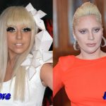 Lady Gaga Before and After Plastic Surgery3 150x150