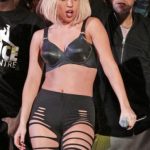 Lady Gaga Plastic Surgery 150x150