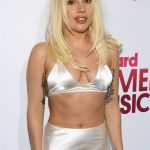 Lady Gaga Plastic Surgery Pictures 150x150