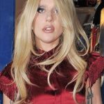 Lady Gaga Plastic Surgery Pictures2 150x150