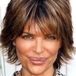 Lisa Rinna Surgery plastic Fail 150x150