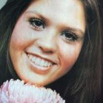 Marie Osmond Before Surgery 150x150