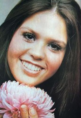 Marie Osmond Before Surgery