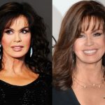 Marie Osmond Surgical Transformation