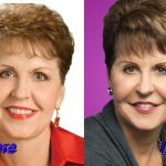 Joyce Meyer Plastic Surgery Before and After2 150x150