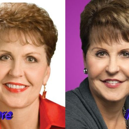Shocking Transformation? The Truth Behind Joyce Meyer's Plastic Surgery