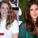 Lana Del Rey Plastic Surgery Before and After 150x150