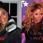 Lil Kim Plastic Surgery 150x150