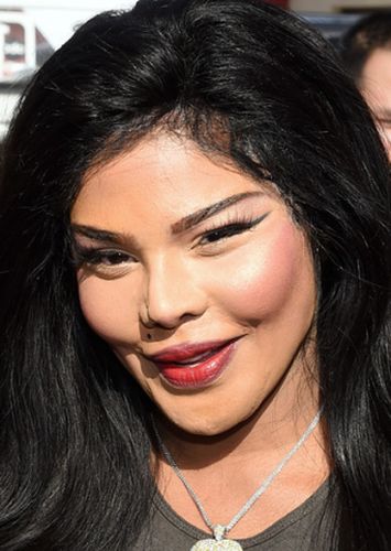 Lil Kim Plastic Surgery Gone Wrong