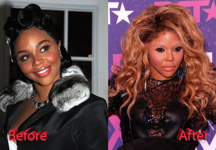 Lil Kim Plastic Surgery