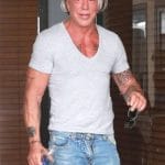 Mickey Rourke After Plastic Surgery