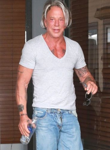 Mickey Rourke After Plastic Surgery