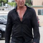 Mickey Rourke Cosmetic Surgery Gone Bad