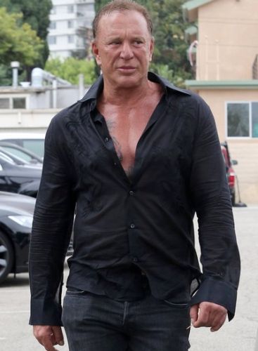 Mickey Rourke Cosmetic Surgery Gone Bad