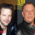 Mickey Rourke Plastic Surgery