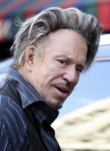 Mickey Rourke Plastic Surgery Disaster