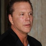 Mickey Rourke Plastic Surgery Disaster2 150x150