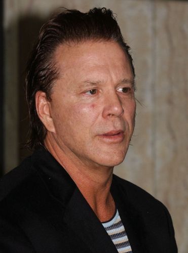 Mickey Rourke Plastic Surgery Disaster2