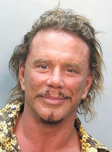Mickey Rourke Plastic Surgery Fail